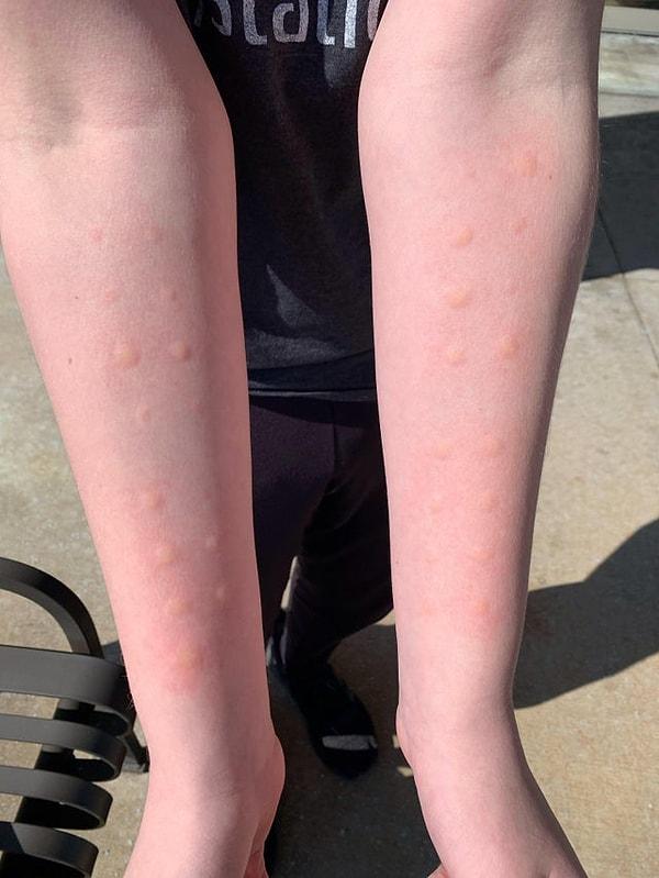 9. "Bugün alerji testine gittim. Havaya bile alerjim varmış."