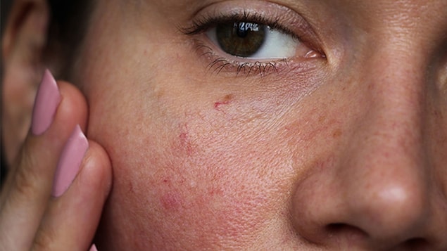 1. Her gün peeling yapmak cildinizi diri tutar.
