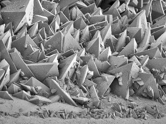 14. Böbrek taşları elektron mikroskobunda bu şekilde görünüyor: