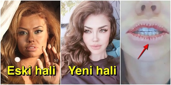 Şarkıcı Lara'nın İnanılmaz Değişimi Yetmiyormuş Gibi Bir de Dudak Ameliyatı Fotoğrafıyla Şok Olduk