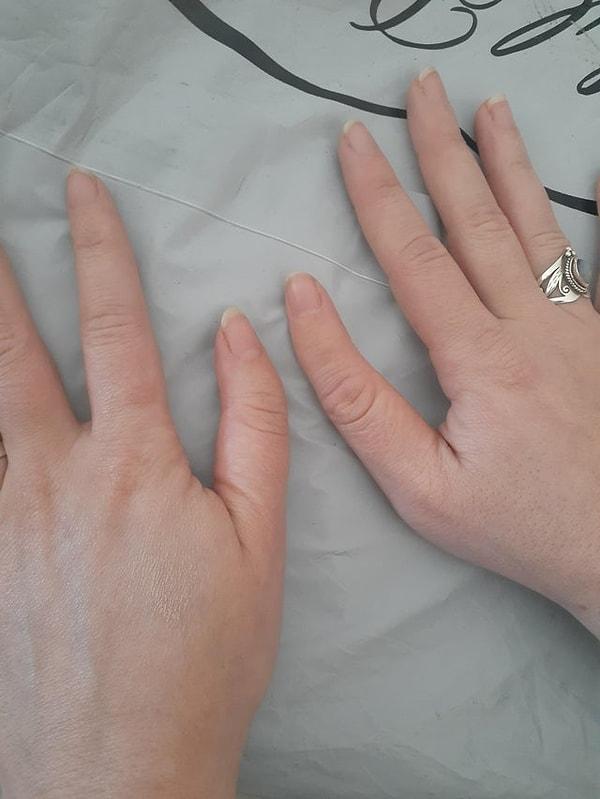 10. "Baş parmağım neredeyse orta parmağımla aynı boyda."