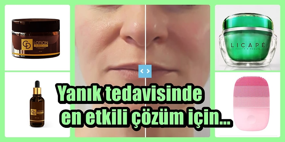 Cildine Nasıl Doğru Bakım Yapabileceğini Anlatıyoruz