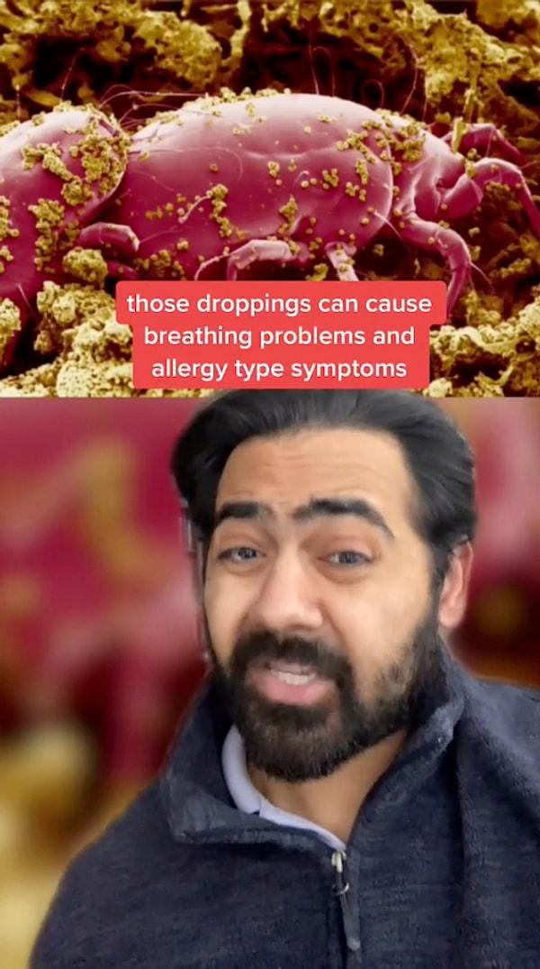 Dr. Karan Raj yastıklarımızı neden iki yılda bir değiştirmemiz gerektiği ile ilgili bir TikTok videosu yayınlamış ve viral olmuş...