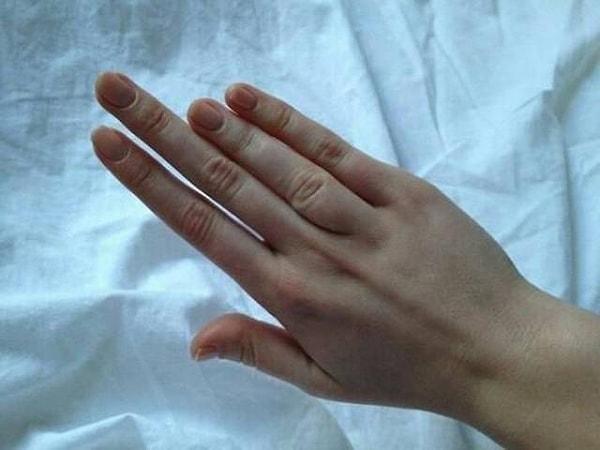 19. "Sağ elimdeki iki parmağım diğerlerine göre gerçekten çok uzun."