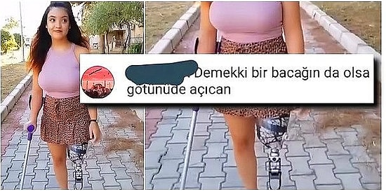 Protez Bacağıyla TikTok Videosu Yayınlayan Kadına Gelen Saç Baş Yoldurtucu İnsanlık Dışı Yorumlar