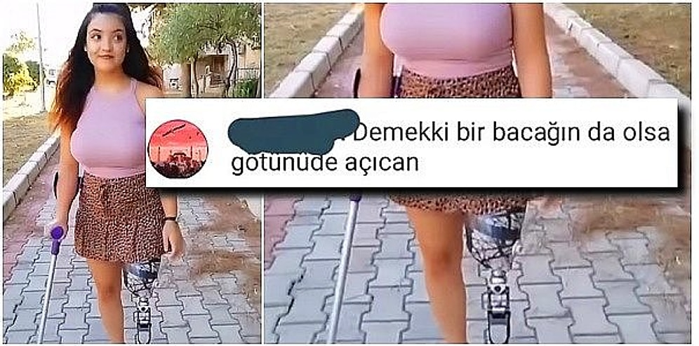 Protez Bacağıyla TikTok Videosu Yayınlayan Kadına Gelen Saç Baş Yoldurtucu İnsanlık Dışı Yorumlar