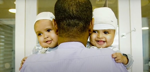 Bütün operasyonlardan sonra ikizler diğer çocuklara göre gelişme konusunda daha yavaştır.
