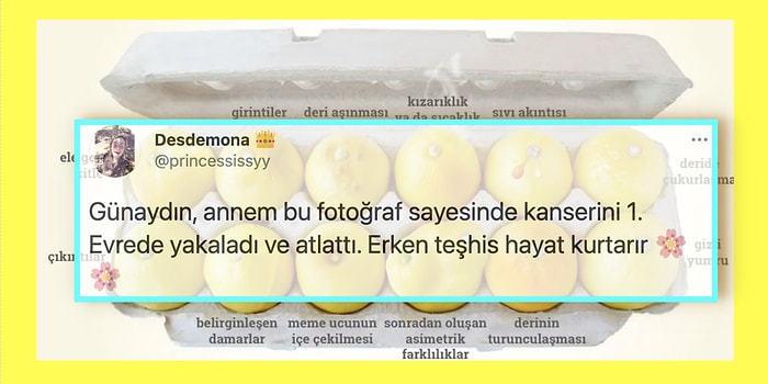 Meme Kanserinin En Önemli Kurtarıcısı Erken Teşhis İçin Evde Kolayca Anlayabileceğiniz 12 Belirti