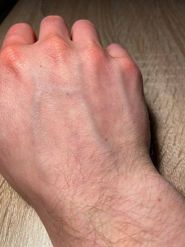 7. "Вены на моей правой руке говорят "Hi" - "Привет!"