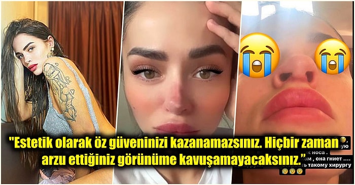 Üç Kez Üst Üste Estetik Olan Anastasia Balinskaya Burnunun Çürüdüğünü Söyleyerek Sevenlerinden Yardım İstedi!