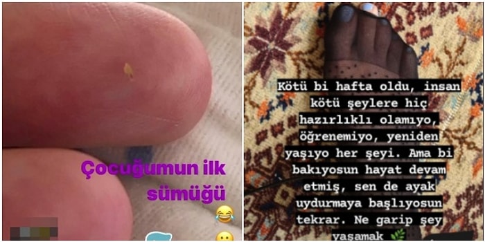 Gördüğünüz Andan İtibaren Gençliğinizden 15 Yılı Çalıp Götürecek Birbirinden Acayip Görseller