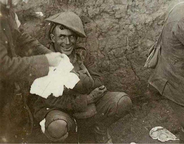 6. Birinci dünya savaşında kullanılan bombalardan sonra şoke olan bu asker: