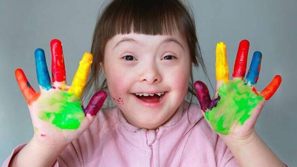 Bugün 21 Mart Down Sendromu Farkındalık Günü! Down Sendromu Nedir? Down Sendromu Hakkında Her Şey...