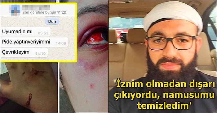 Yine Utandık! Ülkemizin Dört Bir Yanından 'Keşke Yaşanmasaydı' Dediğimiz Olaylar