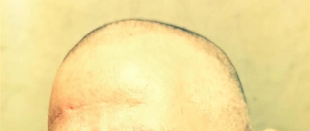 #7