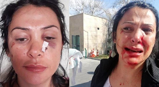 Komşu Dehşeti: Polislerin Gözü Önünde Kalemi Yüzüne Sapladı