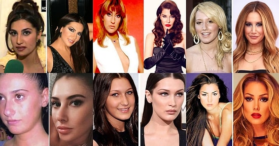 Yaşadıkları Değişimlerle Estetiğe Bakışınızı Değiştirecek Ünlü İsimler