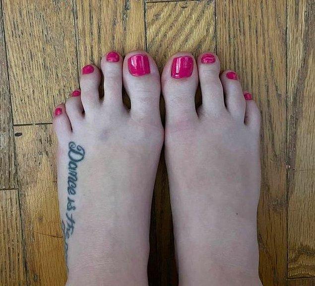 2. "Bir ayağımda 4 parmakla doğdum."