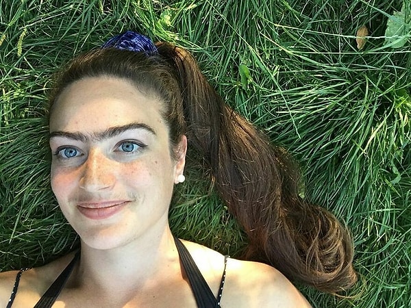 Девушка считает, что ее монобровь и растительность на лице позволили ей выбрать людей, которые не беспокоятся о ее внешности и хотели знать ее как личность