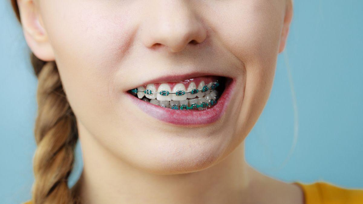 9. Tellerle diş bakımı çok zor, dişler daha kolay çürür.