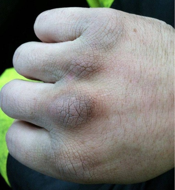 2. "Ребята, будьте добрее к мусорщикам. Нам приходится работать в любую погоду. Вот так выглядят мои руки после 6-часовой смены на холоде".