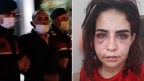 Beyza Yurttaş 'Ölmek İstemiyorum' Demişti: Serbest Bırakılan Saldırgan Tutuklandı!