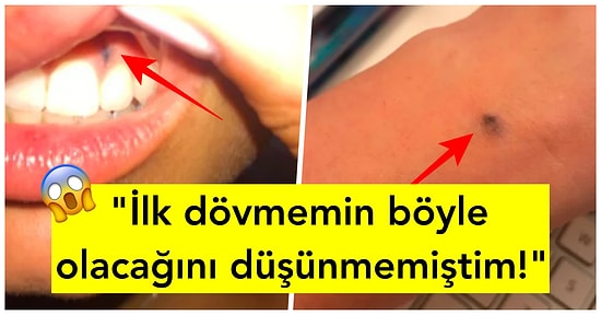 Yalnız Değilsiniz! Zamanında Vücutlarına Kalem Battığı İçin Kalıcı İzlere Sahip Olan 15 Kişi