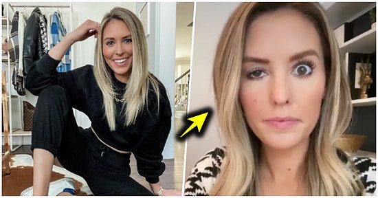 Kırışıklıkları İçin Botoks Yaptıran Influencerın Gözünün Geldiği Son Hali Görünce Epey Şaşıracaksınız!