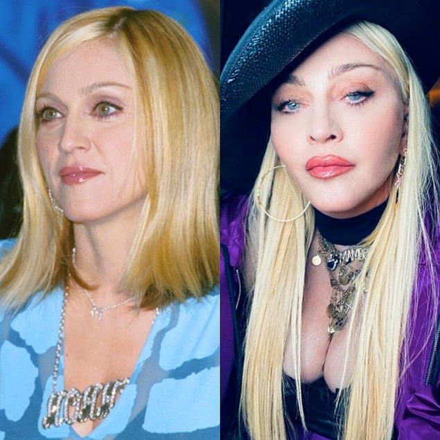 4. Madonna'nın 20 yıl önceki ve günümüzdeki hali: