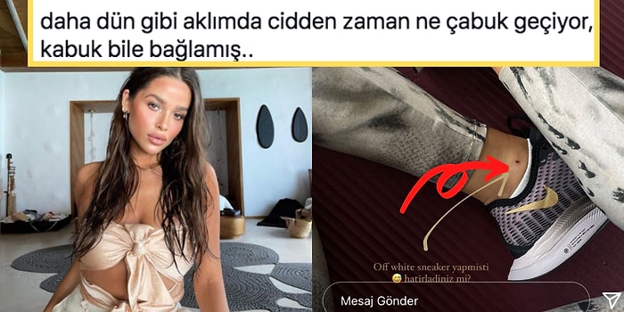 Ayağındaki Yarayı Ayakkabı Markasıyla Birlikte Hatırlatan Fenomen Ezgi Fındık'a Yapılan Güldüren Yorumlar