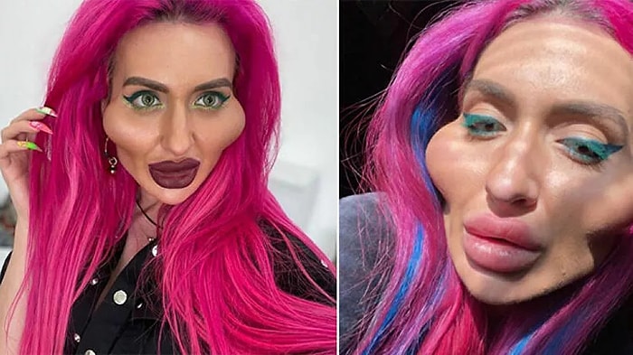 Украинская модель Анастасия Покрещук стала обладательницей самых больших в мире скул