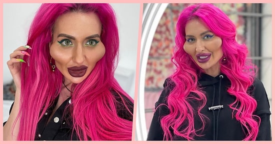 Dünyanın En Büyük Elmacık Kemikli Yanaklarına Sahip Olan Ukraynalı Model: Anastasia Pokreshchuk