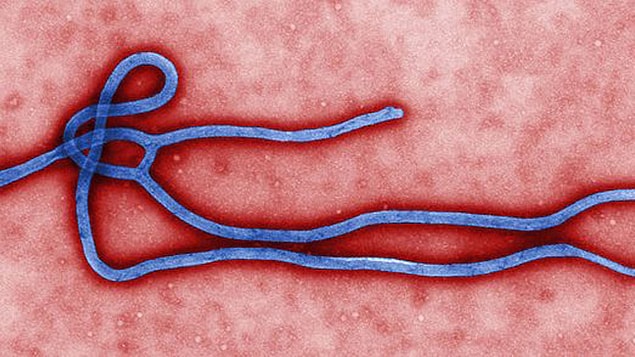 "Ebola" çıktı!