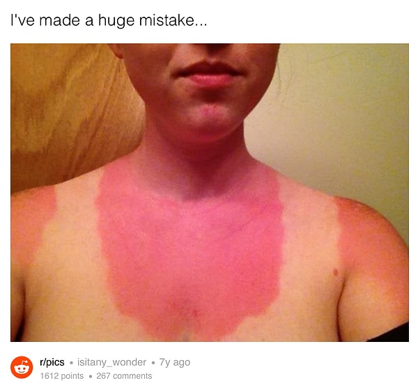 5. Ну что такого страшного может произойти, если не намазаться солнцезащитным средством в солнечный день?