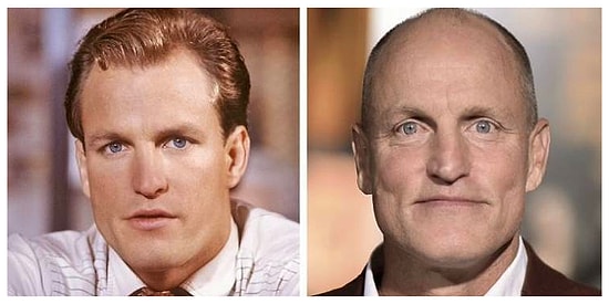 10 знаменитых мужчин, которые потеряли свои волосы, но не свое очарование