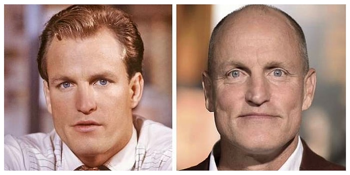 10 знаменитых мужчин, которые потеряли свои волосы, но не свое очарование