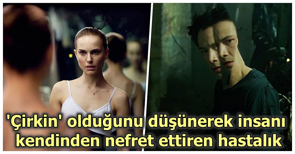 Aynaya Bakınca Kusurdan Başka Bir Şey Göremeyen İnsanların Sahip Olduğu Hastalık: Beden Dismorfik Bozukluğu