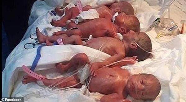 Malili Halime Sisi, sezaryen yöntemi ile bebeklerine kavuştu ve 5'i kız 4'ü bebeklerin durumunun iyi olduğu aktarıldı.