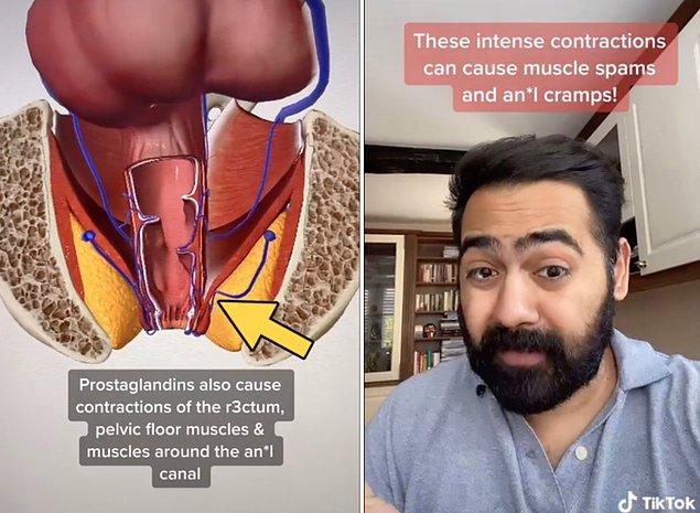 "Prostaglandinler ayrıca rektumun, pelvik taban kaslarının ve anal kanal çevresindeki kasların kasılmasına neden olur."