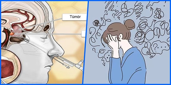 Hamilelik Planlaması İçin Gittiğim Doktordan Hipofiz Bezi Tümörü ve PCOS İhtimali ile Ayrılışımı Anlatıyorum!