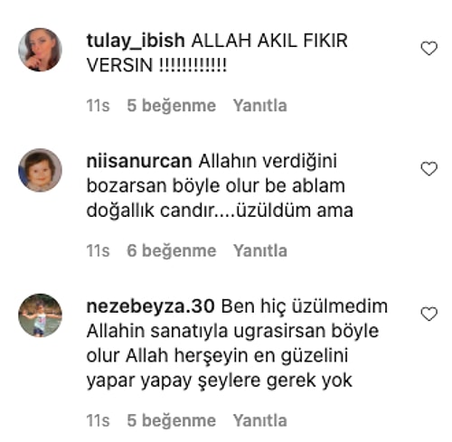 Estetik Ameliyatla Dudaklarını Küçülttürüp İçimizi Bir Tuhaf Eden Lara, Ağlayarak Pişman Olduğunu Söyledi