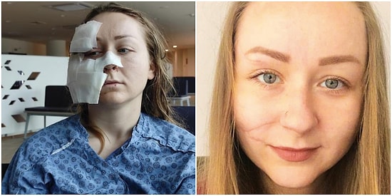 Kocası Yüzünü Falçatayla Kesmişti! Ukraynalı Hanna'nın Hayata Tutunma Hikayesi