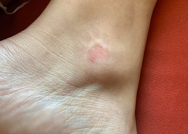 2. «Мой кот ночью спит на моих ногах. Следы его лапы остались на ноге». 😍