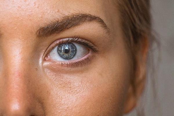 7. Gözlerimizin vücudumuzun bağışıklık sistemi haricinde kendine ait bir bağışıklık sistemi vardır.