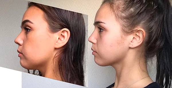 2. Son dönemin en popüler estetik işlemlerinden olan jawline dolgusunu makyajla yapmaya ne dersin?