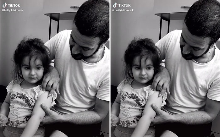 Çocuklarına Kolundaki Beni Anlatmaya Çalışan Çiftin Aşırı Zor Anları