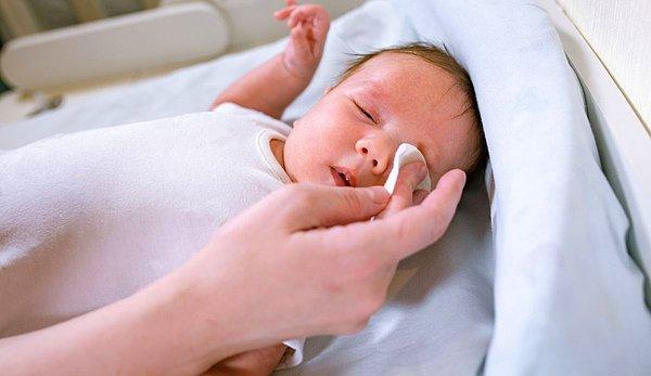 Bebeklerde Göz Kaşıntısı ve Kızarıklığının Nedenleri