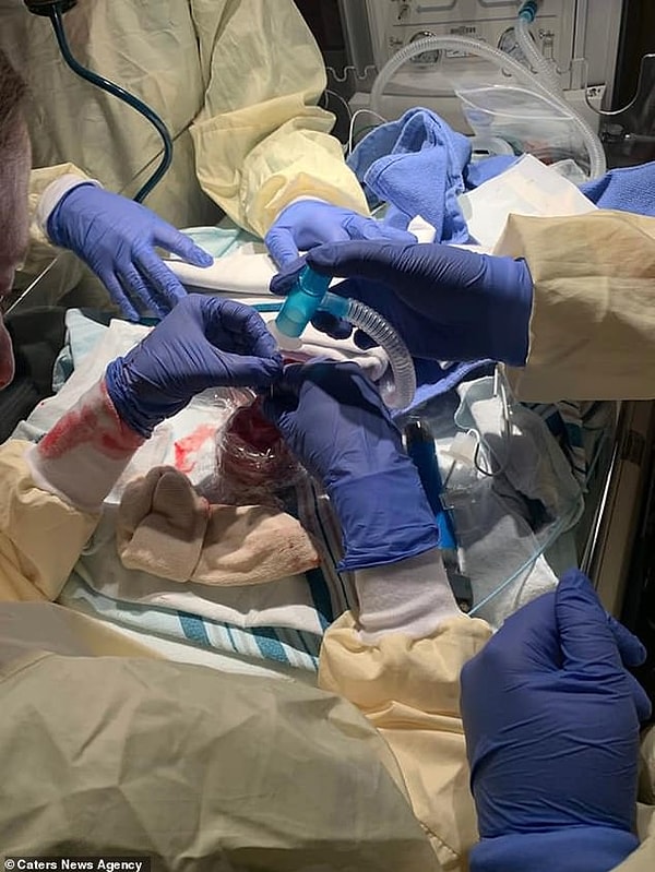 Один из тройни находится в отделении интенсивной терапии новорожденных.