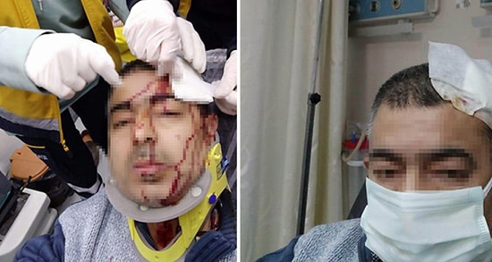 İmamın Tabureyle Saldırdığı Müezzinin Kafasına 10 Dikiş Atıldı