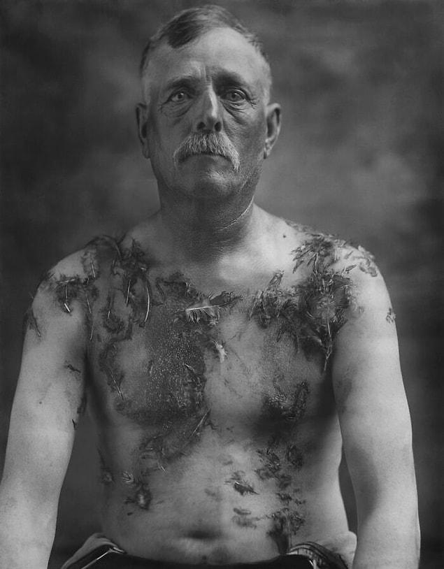 23. Amerikalı çiftçi John Meintz. Alman asıllı olduğu ve milli savunma tahvilini desteklemediği için bir çete tarafından katrana bulanmış ve üstüne tüyler yapıştırılmış. (1918)